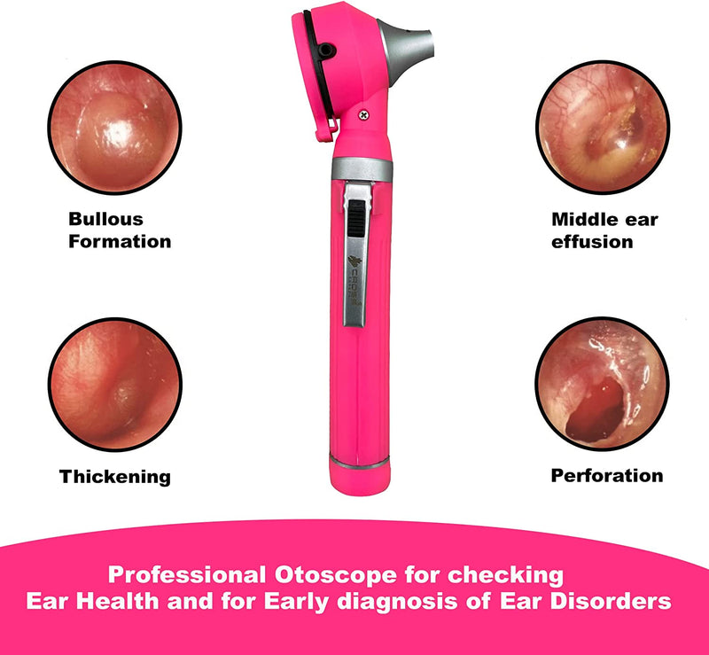 Cross Canada 11-080 Physician Fiber Optic LED Pocket Otoscope Diagnostic Set, Pink