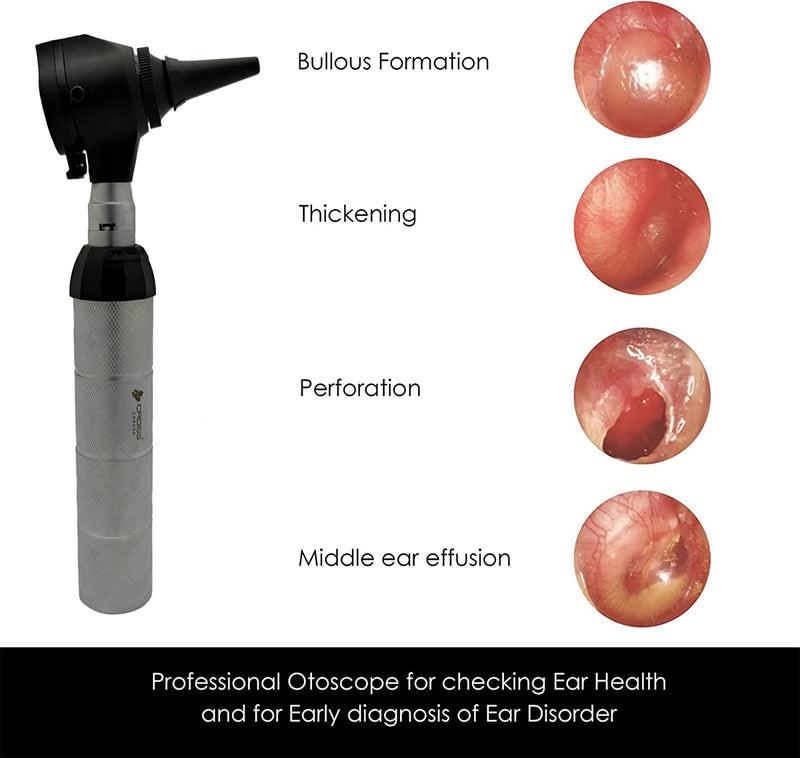 Cross Canada 11-094 Physician LED Otoscope Diagnostic Set