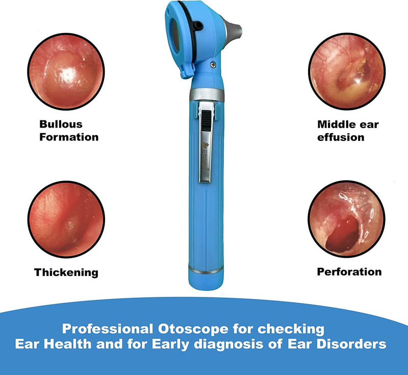 Cross Canada 11-079 Physician Fiber Optic LED Pocket Otoscope Diagnostic Set, Ceil Blue