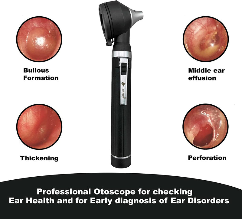 Cross Canada 11-083 Physician Fiber Optic LED Pocket Otoscope Diagnostic Set, Black