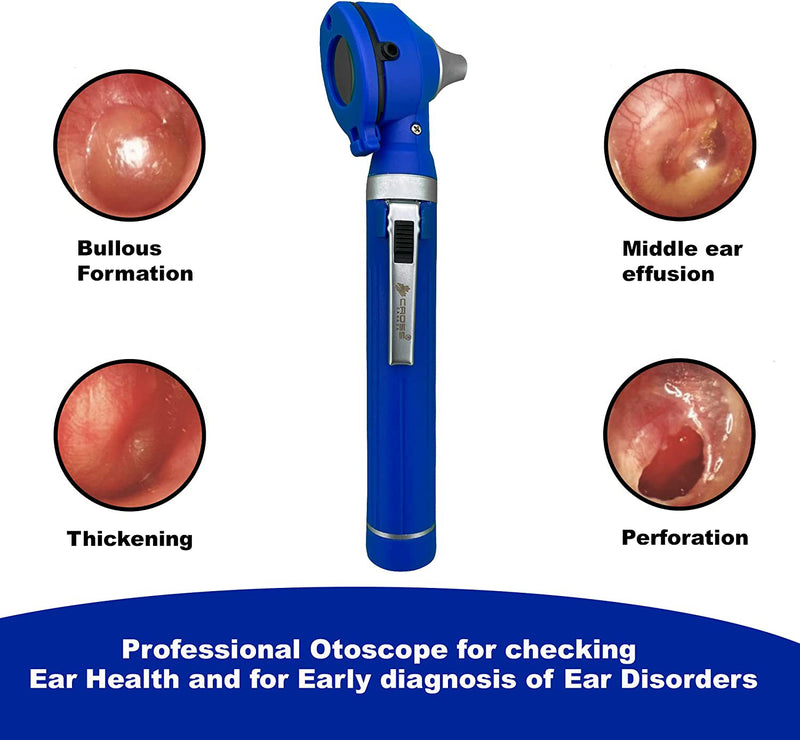 Cross Canada 11-081 Physician Fiber Optic LED Pocket Otoscope Diagnostic Set, Blue